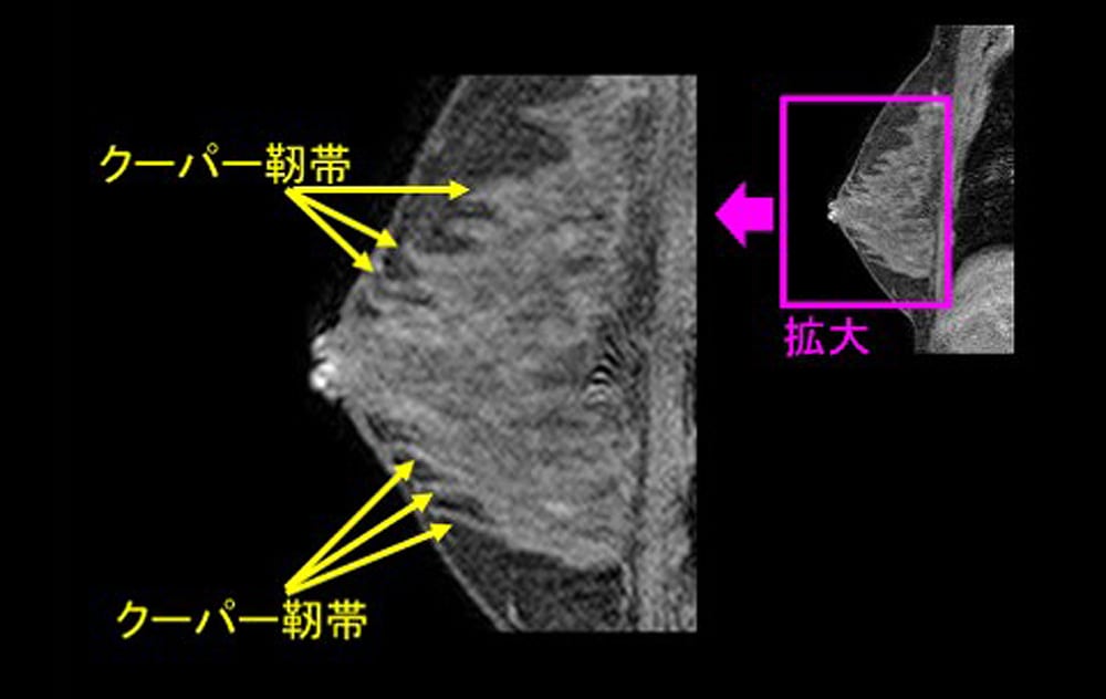 記事画像