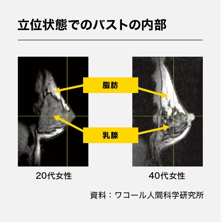 立位状態でのバストの内部