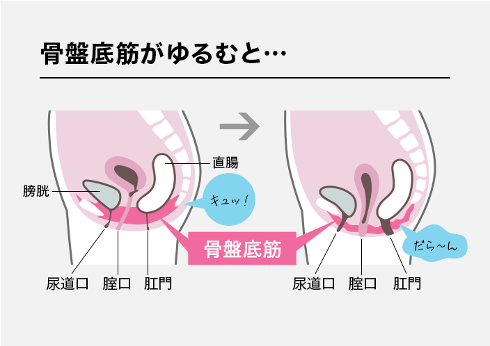 骨盤底筋がゆるむと…