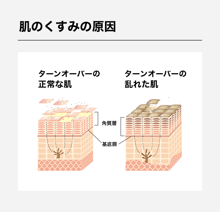 肌のくすみの原因